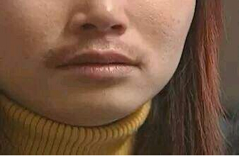 微量元素檢測儀女神節福利女性長胡子內分泌紊亂 微量元素檢測儀女神節福利女性長胡子內分泌紊亂