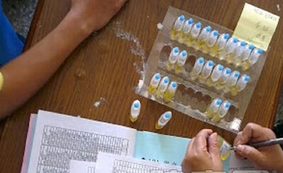 尿液分析儀檢測尿液常規,腎健康的鏡子 尿液分析儀檢測尿液常規,腎健康的鏡子