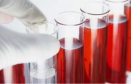血液微量元素分析儀闡述微量元素與健康 血液微量元素分析儀闡述微量元素與健康