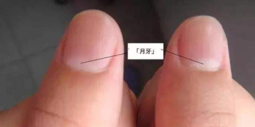 手指上沒有月牙是缺少微量元素導致,月牙的多少就是健康的標準 手指上沒有月牙是缺少微量元素導致,月牙的多少就是健康的標準
