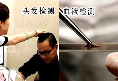 微量元素檢測儀介紹做身體微量元素檢查用頭發還是血液哪個更靠譜 微量元素檢測儀介紹做身體微量元素檢查用頭發還是血液哪個更靠譜