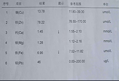 微量元素檢測儀價格多少我要去醫院做一次微量元素檢查多少錢? 微量元素檢測儀價格多少我要去醫院做一次微量元素檢查多少錢?