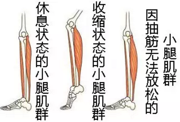 鈣鐵鋅硒檢測儀廠家 鈣鐵鋅硒檢測儀廠家經常腿抽筋不僅是缺鈣還可能有這些原因你了解嗎?